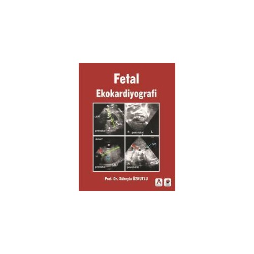  Fetal Ekokardiyografi