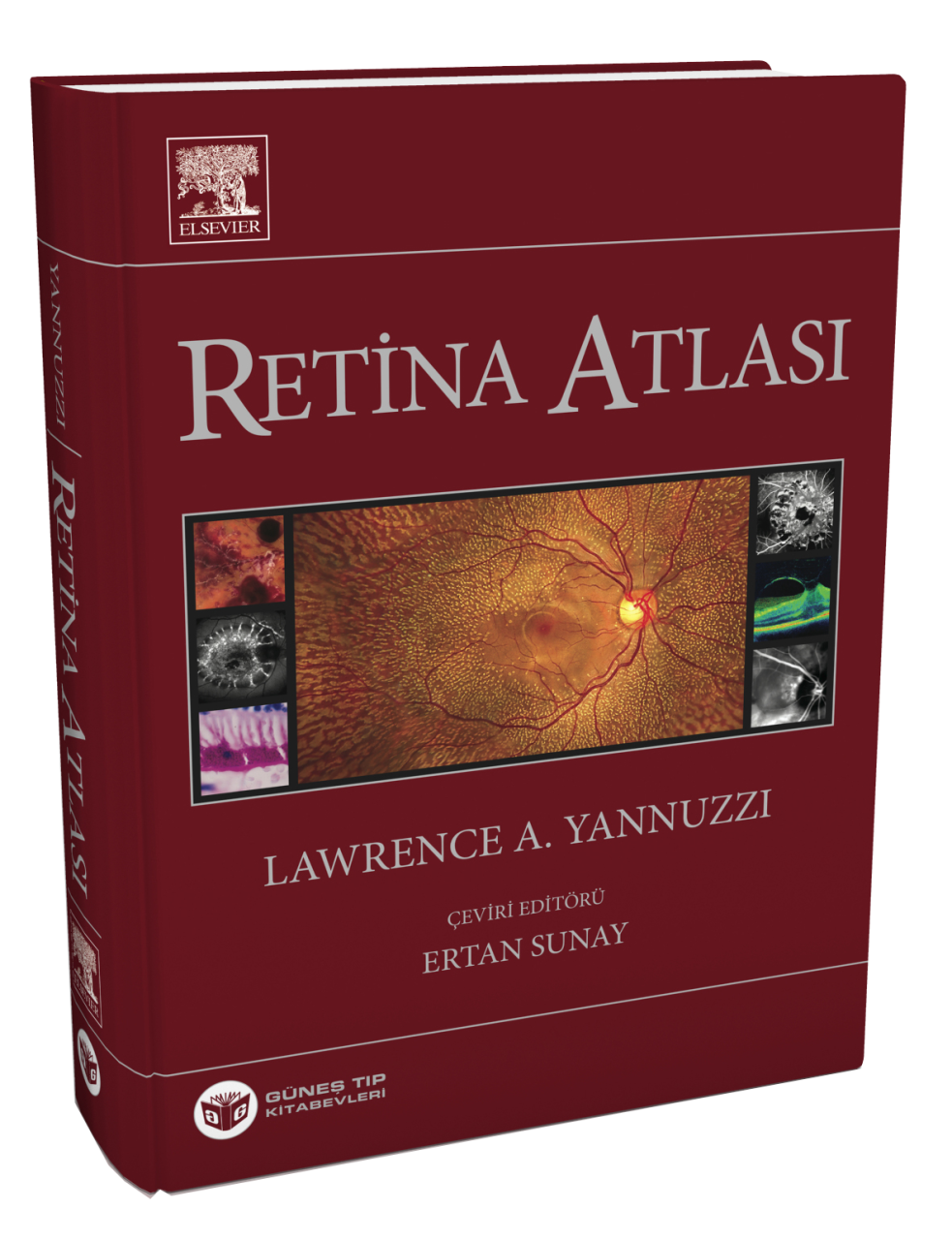 Yannuzzi Retina Atlası